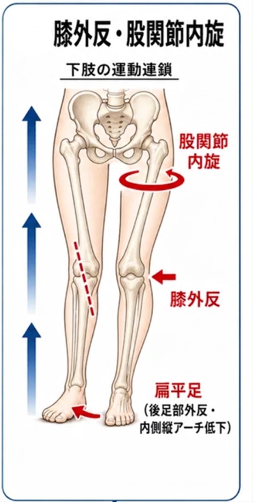 姿勢と足の負担の関係図