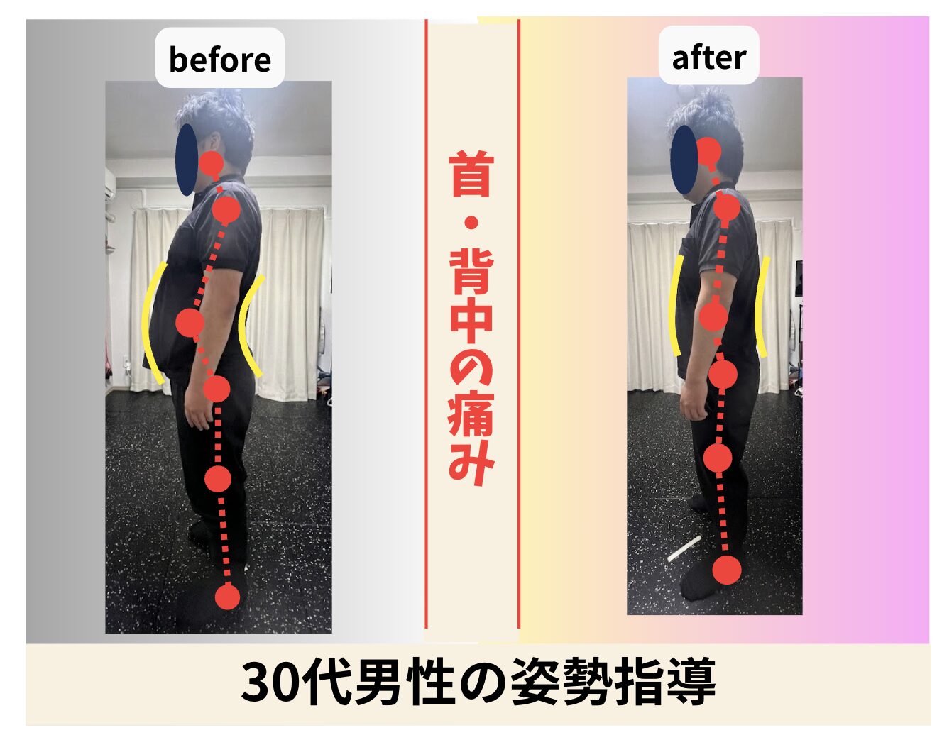 30代男性 首・背中の痛みの姿勢指導 ビフォーアフター｜大阪市旭区・関目高殿の整体院 友