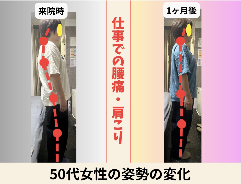 50代女性 姿勢の変化 ビフォーアフター｜大阪市旭区・関目高殿の整体院 友